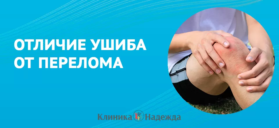 Как отличить ушиб от перелома: важные признаки и первая помощь