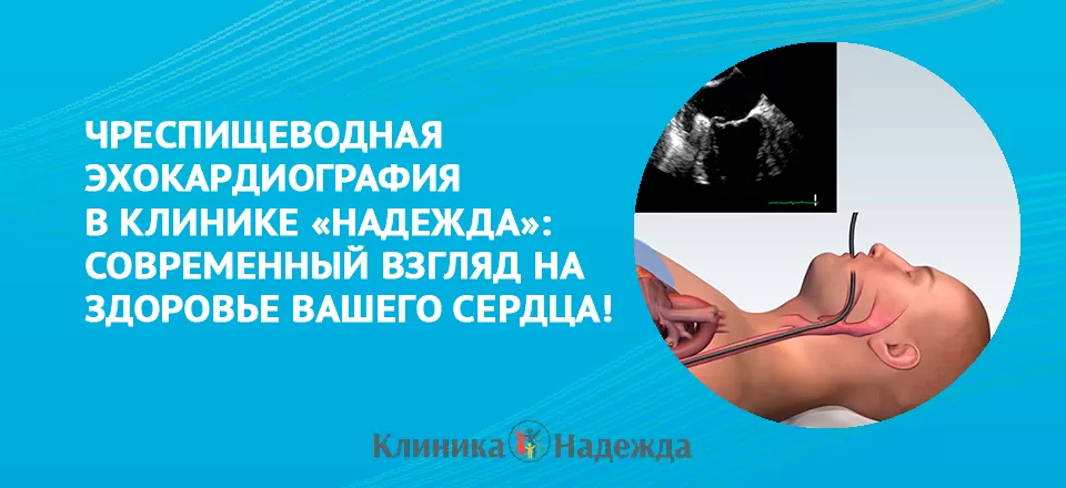 ЧПЭХО-КГ в клинике "Надежда": современный подход к диагностике сердечно-сосудистых заболеваний!