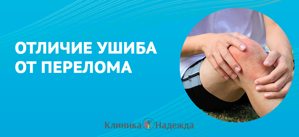 Как отличить ушиб от перелома: важные признаки и первая помощь