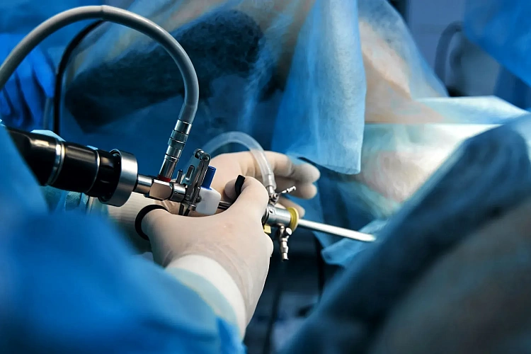 Полипы в матке: стоит ли бояться и что с ними делать